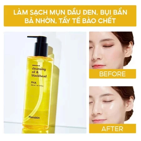 [DATE T1/2027] Dầu Tẩy Trang Hanskin BHA, PHA Làm Giảm Sợi Bã Nhờn Và Sạch Sâu Lỗ Chân Lông - Ever Queen