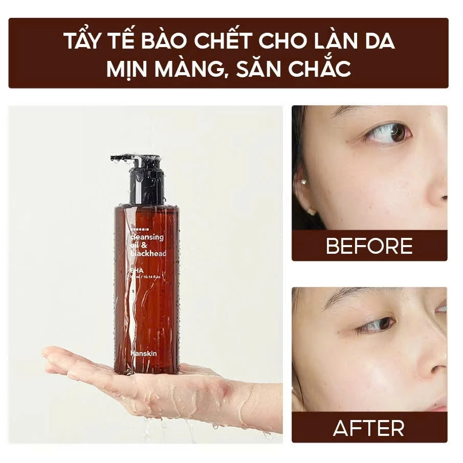 [DATE T1/2027] Dầu Tẩy Trang Hanskin BHA, PHA Làm Giảm Sợi Bã Nhờn Và Sạch Sâu Lỗ Chân Lông - Ever Queen