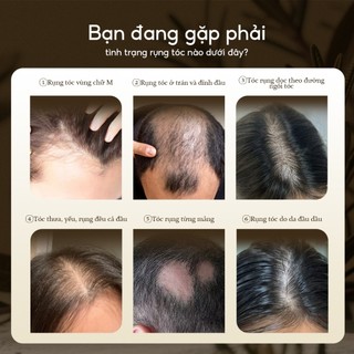 Xịt Mọc Tóc Lab On Hair 160ml - Giấm Táo Kích Thích Mọc Tóc, Giảm Rụng Tóc Hiệu Quả, Củng Cố Chân Tóc Cho Tóc Mọc Chậm