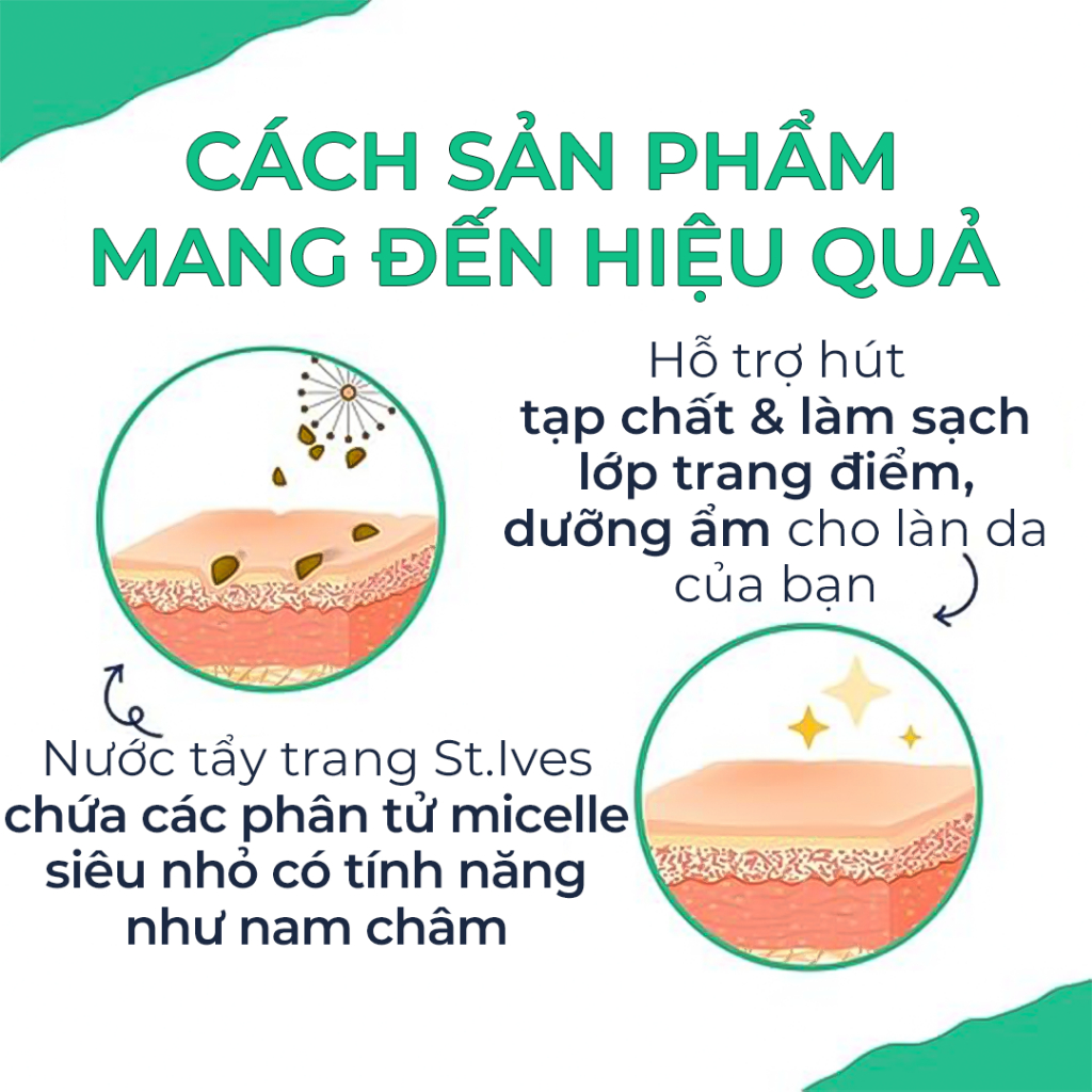 [SẢN PHẨM MỚI] Combo 02 Nước tẩy trang St.ives Micella 400ml (Tùy chọn)