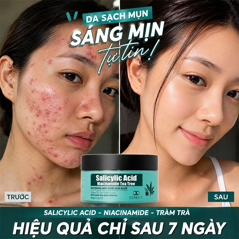 LYDIMOON Mặt nạ đất sét axit salicylic 100g, loại bỏ mụn đầu đen kiềm dầu sạch mụn dưỡng trắng sáng da