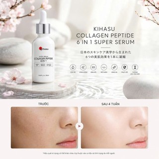 Serum Dưỡng Sáng Da Mờ Thâm Mụn Serum Chứa Niacinamide Vitamin C Và Collagen Chai 50ml