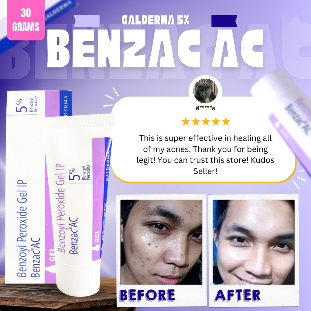 Gel Chấm Mụn Benzac Ac Benzoyl 2,5% 5% Adapalene Dưỡng Trắng Cấp Ẩm Giảm Mụn Mờ Thâm Sẹo 30g
