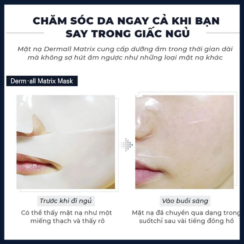 Mặt Nạ Thạch Derm-All Matrix  Facial Dermal Care Mask - Ever Queen