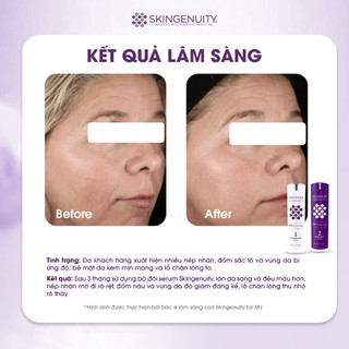 [Date 02/2027] Combo Serum tái tạo và phục hồi da SkinGenuity