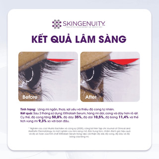 Tinh chất mọc mi, dưỡng dài và dày mi SkinGenuity Xxtralash 3ml