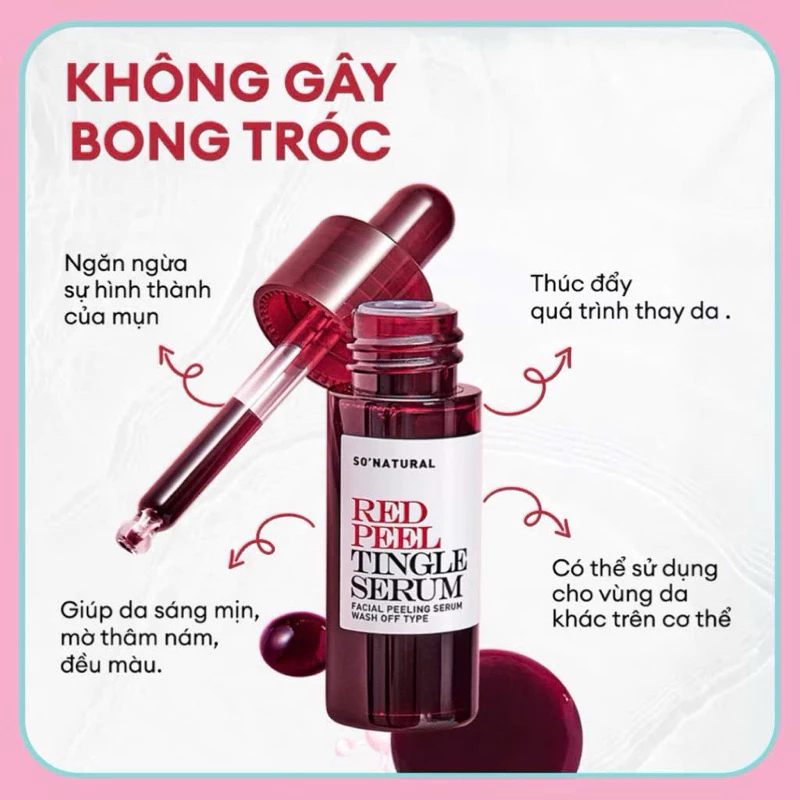 Tinh Chất Red Peel Tingle So Natural Giảm Thâm Và Làm Trắng Da - Ever Queen