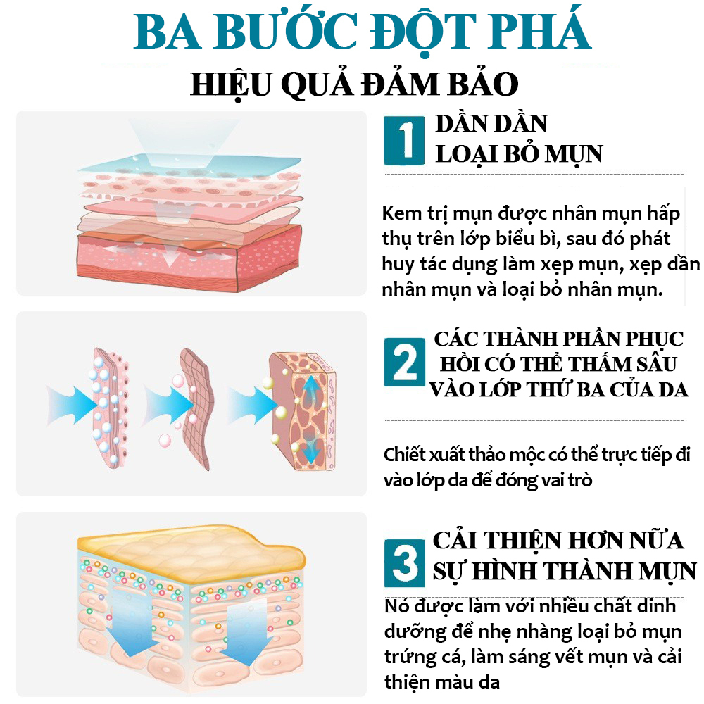 kem chấm mụn Gel giảm mụn, chóng loại bỏ mụn bọc,giảm thâm ngăn mụn tái phát, kem bôi mụn làm mờ thâm mụn