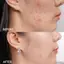 Kem Dưỡng Trắng Rau Má Prettyskin Chính Hãng The Pure Jeju Cica 52ml
