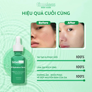 Tinh chất Serum Timeless phục hồi và cấp ẩm da Vitamin B5 + Hyaluronic Acid 30ml tem phụ