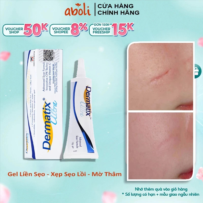 Dermatix Ultra 15g Kem Ngừa Sẹo, Thâm, Mụn Dưỡng Da – Dứt Điểm Sau Vài Ngày