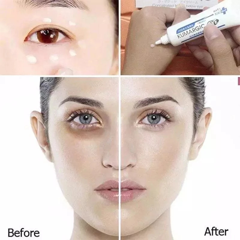 Kumargic Eye Cream for Dark Circles Under Eyes 20g