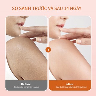 Tinh chất Hỗ trợ dưỡng trắng nâng tông UILICY – Chống nắng SPF30 PA+++ Serum dưỡng thể Serum Hỗ trợ làm trắng da toàn