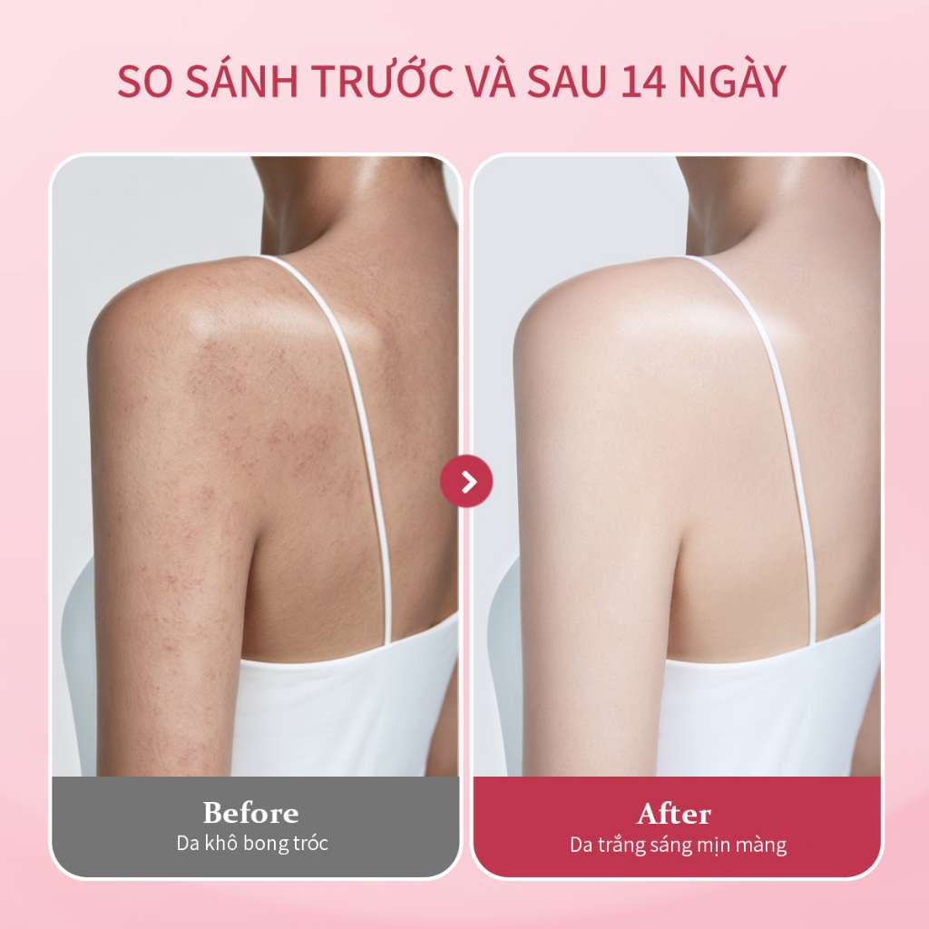 Tinh chất dưỡng trắng toàn thân UILICY 200ml Serum dưỡng thể Hỗ trợ Làm trắng 2%Niacinamide Symwhite377 Rose