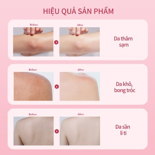 Sữa Tắm Cánh Hoa UILICY 300ml*2 2% Niacinamide Symwhite377 - Dưỡng Trắng Da Liệu Pháp SPA Hương Cerisier Amoureux