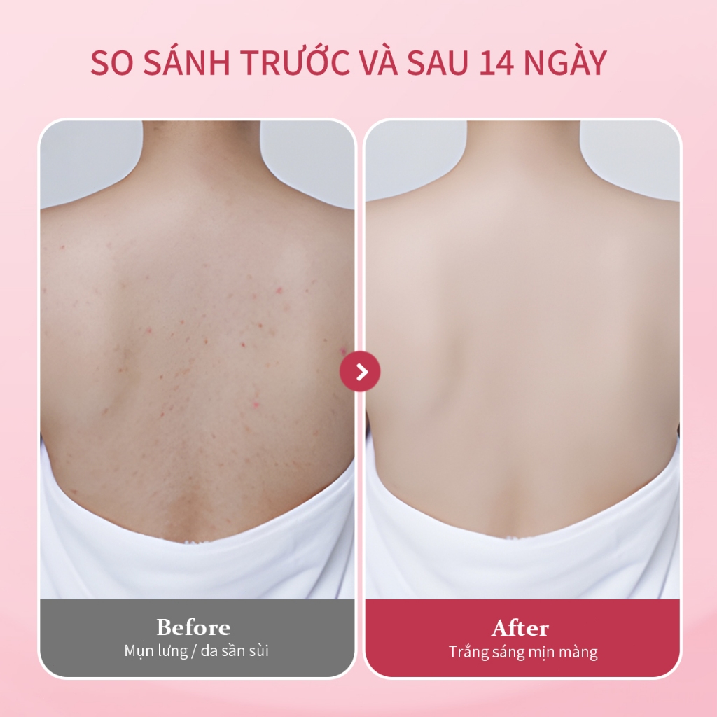 Sữa Tắm Cánh Hoa UILICY Làm Sạch Dịu Nhẹ - 2% Niacinamide Symwhite377 Dưỡng Trắng Nhiều Hương Nước Hoa Pháp