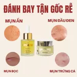 Bộ hỗ trợ Giảm Mụn Mờ Thâm Doctor Care Dành Cho Da Dầu mụn ( serum giảm mụn + kem giảm mụn Acnes Elimination Cream ) — ảnh 2