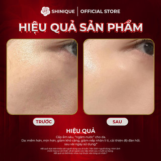 SHINIQUE Extra Advanced HA Ampoule - Serum Phức Hợp 8 Loại HA và 10x 5 Peptide, Cấp Ẩm Đa Tầng, Hỗ Trợ Mờ Nếp Nhăn 30ml