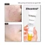 Kem Dưỡng Kiềm Dầu Giảm Mụn Acnemy Zitcontrol Blemish Control Moisturizer 40ml