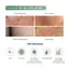 COMBO Peel Glowy 50g, kem dưỡng Juicy 50g giúp làm sáng, giảm thâm mông, nách, bikini, đầu gối (ver 2.0)