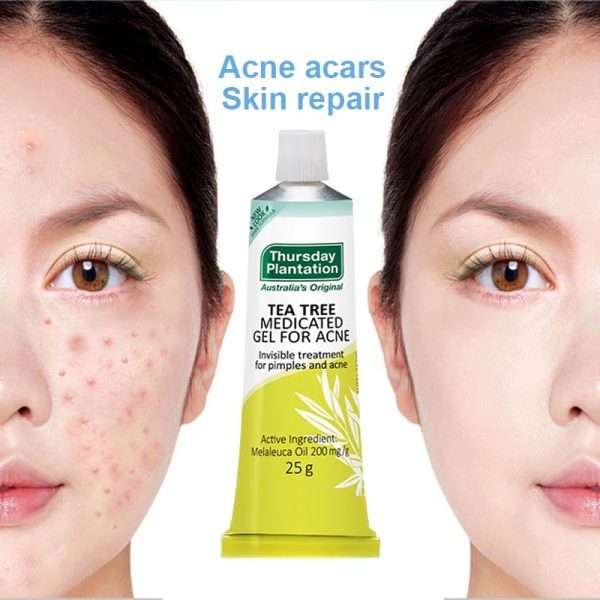 Thursday Plantation Tea Tree Medicated Gel For Acne 25g Giảm Mụn Làm Dịu Da Chính Hãng Úc