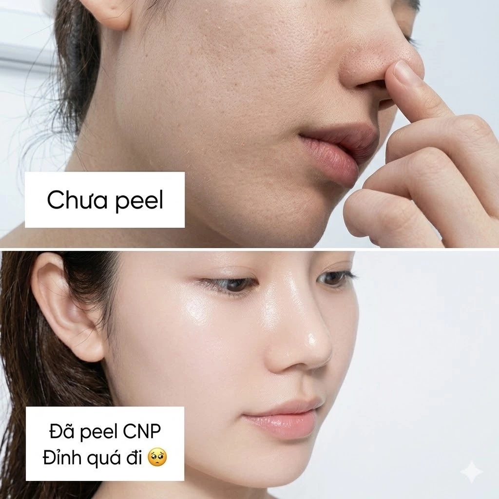 [Top 1 bán chạy] Sample Peel tái tạo da chuyên sâu CNP Rx Skin Intensive Peel - AB Authentic