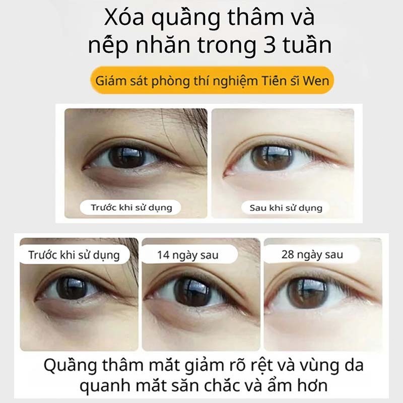 [MỚI]  Tinh chất dưỡng mắt VC - Giúp tan bọng mắt, giảm quằng thâm mắt, dưỡng ẩm làm dịu cho mắt