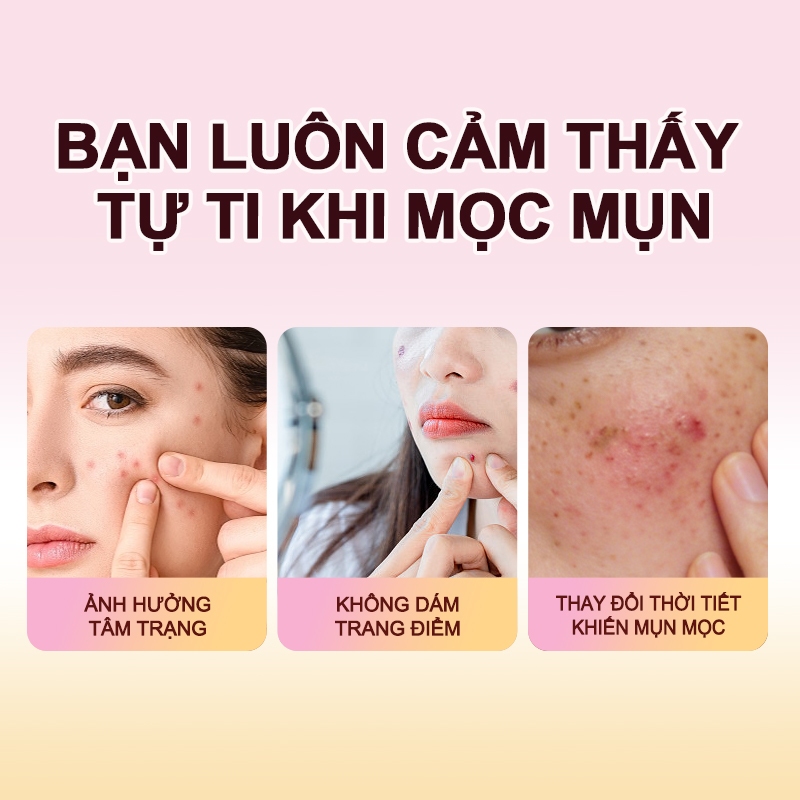 Miếng dán mụn HEXZE hình mèo dễ thương hỗ trợ kháng khuẩn, lành mụn nhanh
