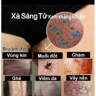 COMBO 3 Kem XÀ SÀNG TỬ bôi nấm ngứa, kháng khuẩn, giảm ngứa, chiết xuất từ thảo dược
