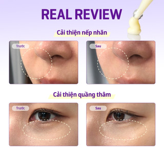 Kem dưỡng mắt Retinol 0.1% Giảm Nếp Nhăn, Quầng Thâm Some By Mi Retinol Intense Advanced Triple Action Eye Cream 30ml