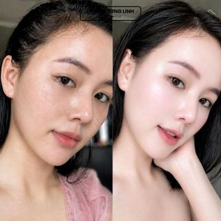 Combo Kem Nền BB Cream Cellgigir + Kem Dưỡng DERMAXILIC B5 CB0360 - Nâng tone, Dưỡng Trắng, Bảo Vệ Da Toàn Diện