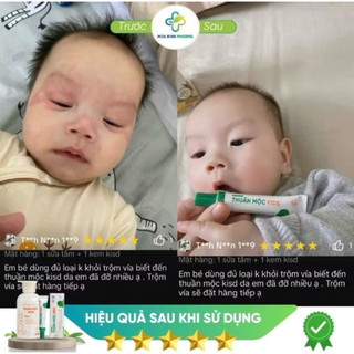 COMBO DẦU GỘI - KEM BÔI NẤM NGỨA THUẦN MỘC KIDS