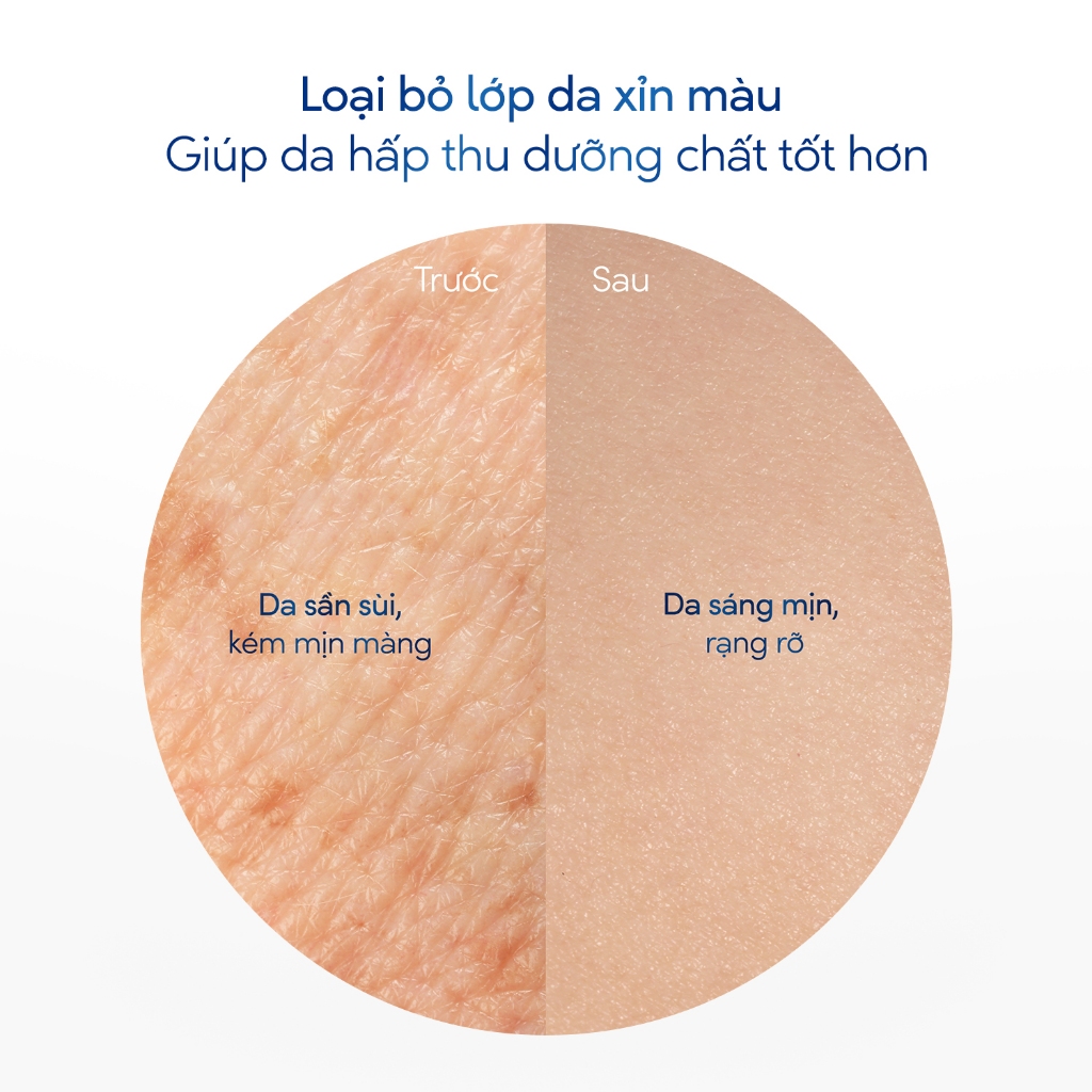 [HANNAH LIVESTREAM] [CHÍNH HÃNG ĐỘC QUYỀN] Smoothie Tẩy Tế Bào Chết Body Dove Chăm Da Sáng Mịn 298g/280g | BigBuy360 - bigbuy360.vn