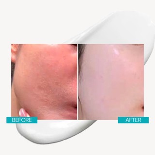 Kem dưỡng căng bóng & trẻ hóa M.Asam AQUA INTENSE Supreme Hyaluron Cream 50ml