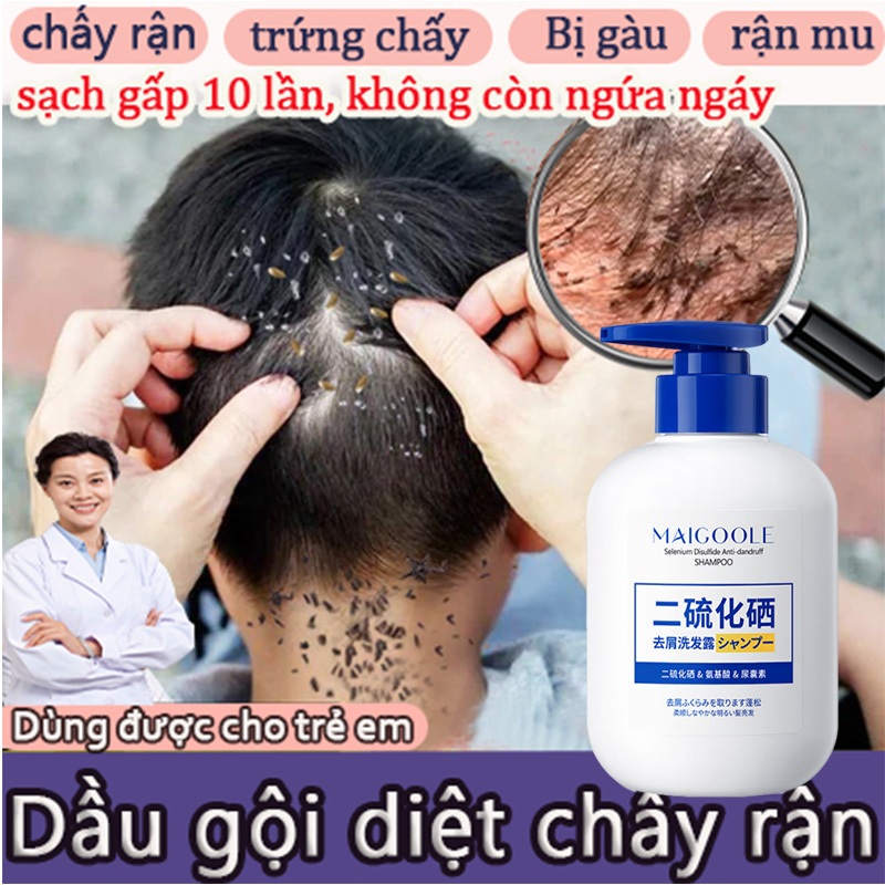 dầu gội diệt chấy dầu gội sạch gàu 300ml giảm ngứa nhanh chóng làm sạch sâu da đầu diệt bọ ve