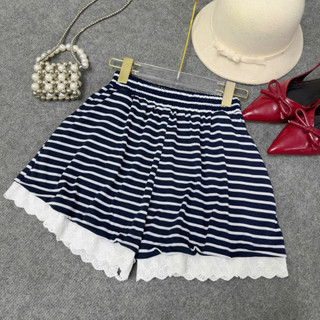Quần Short Bigsize Nữ Kẻ Sọc Ngang Phối Viền Ren Dễ Thương Năng Động Cho Chubby Q578 Q579