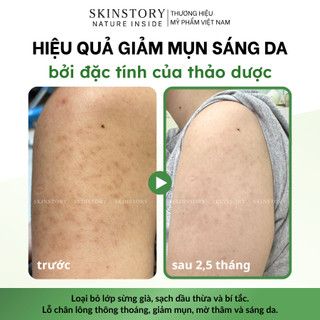 Bột Tắm Trắng Body Toàn Thân Green Brighten, Ủ Trắng Toàn Thân Thảo Mộc, Skinstory 300gr