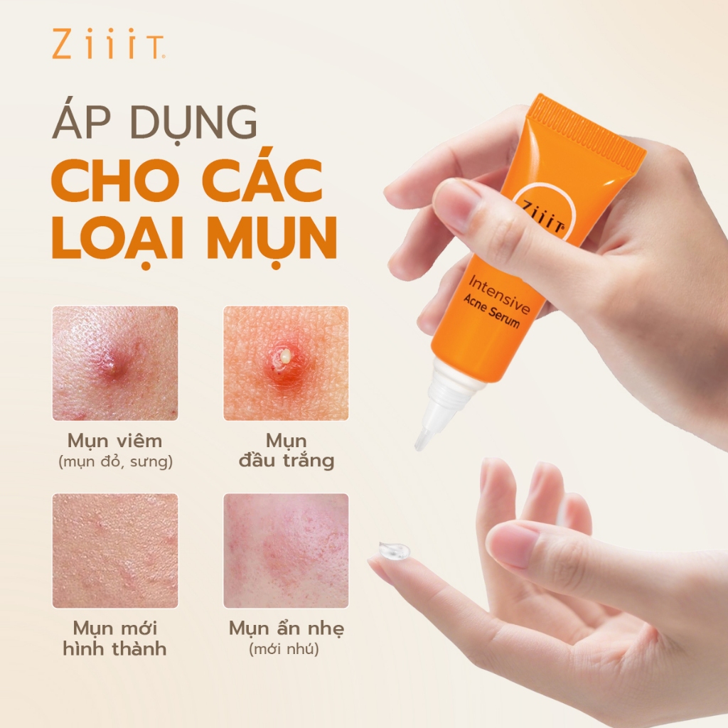 Gel Chấm Mụn Trứng Cá Mờ Thâm Dành Cho Da Dầu Mụn BHA ZiiiT Quix 5g