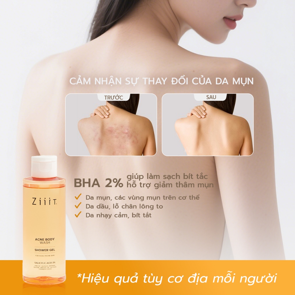 Sữa Tắm Giảm Mụn Lưng BHA 2% Kháng Khuẩn, Giảm Dầu Cho Da Nhạy Cảm ZiiiT 280ml