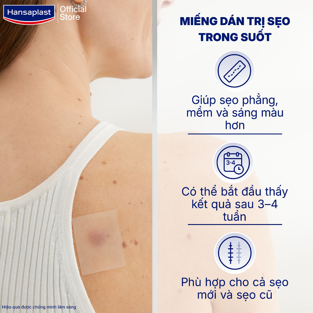 [MỚI] Miếng dán giảm sẹo HANSAPLAST 21 miếng | Đã được chứng minh lâm sàng | Dùng cho sẹo cũ và mới