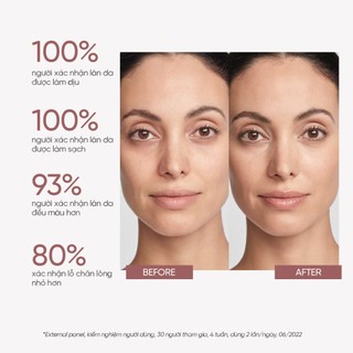 Nước cân bằng tinh chỉnh lỗ chân lông M.Asam MAGIC CARE Better Face Toner 150ml