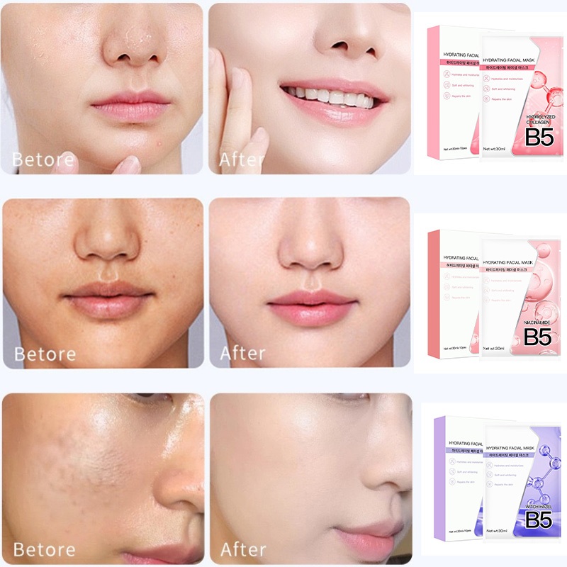 Hộp 10 Miếng Mặt Nạ B5 YUEJIIN - Dưỡng Ẩm Sâu Làm Dịu Da Hỗ Trợ Làm Sáng Da Cấp Nước Phục Hồi Da Khô Nhạy Cảm