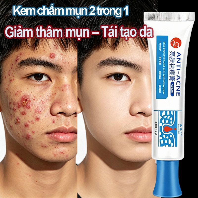 Kem chấm mụn 2 trong 1 giảm sưng đỏ thâm mụn, kháng khuẩn, làm sạch da cho mụn tuổi dậy thì