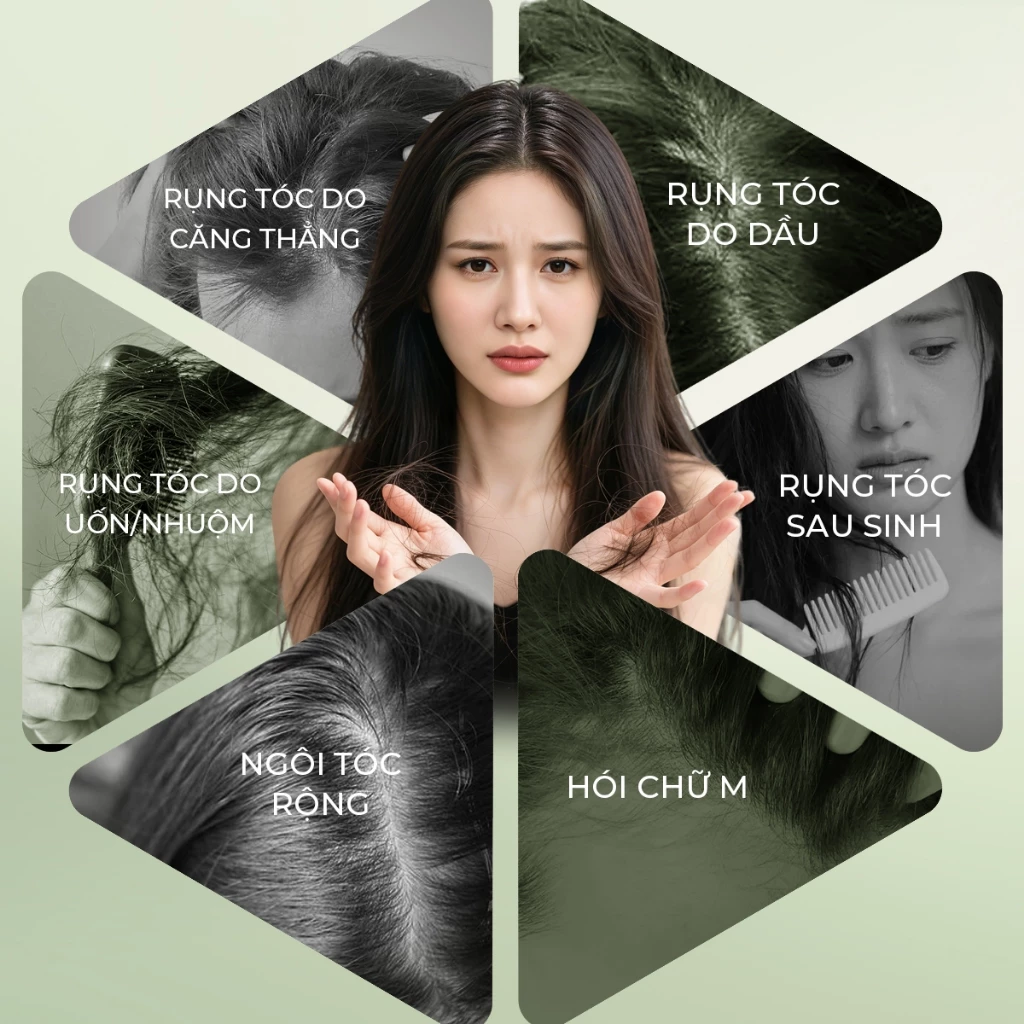 Xịt mọc tóc Lab on Hair