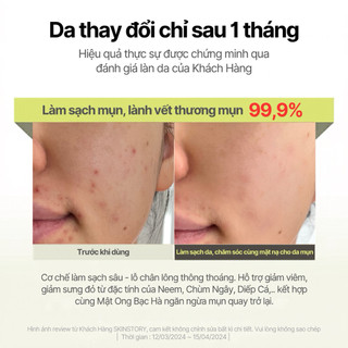 Mặt nạ dưỡng ẩm Teas 120g Skinstory Việt Nam, mặt nạ thảo mộc làm sạch da, giảm mun, phục hồi da, hỗ trợ giảm thâm