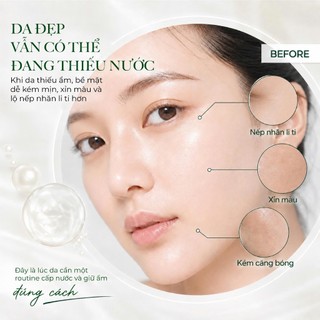 [MỚI] COMBO SERUM & KEM DƯỠNG NẤM TUYẾT C'CHOI – DƯỠNG ẨM, SÁNG DA, HỖ TRỢ CHỐNG NHĂN & LÀM MỜ DẤU HIỆU LÃO HÓA