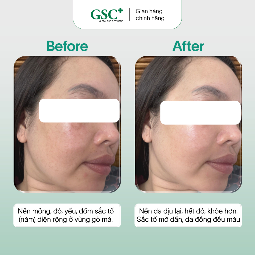 Kem Nám Tàn Nhang Hàn Quốc GSC Alpha Arbutin Ultra Cream 15g – Kem Hỗ Trợ Làm Mờ Và Ngăn Ngừa Thâm Nám - GC090A