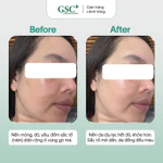 Kem Nám Tàn Nhang Hàn Quốc GSC Alpha Arbutin Ultra Cream 15g – Kem Hỗ Trợ Làm Mờ Và Ngăn Ngừa Thâm Nám - GC090A — ảnh 4