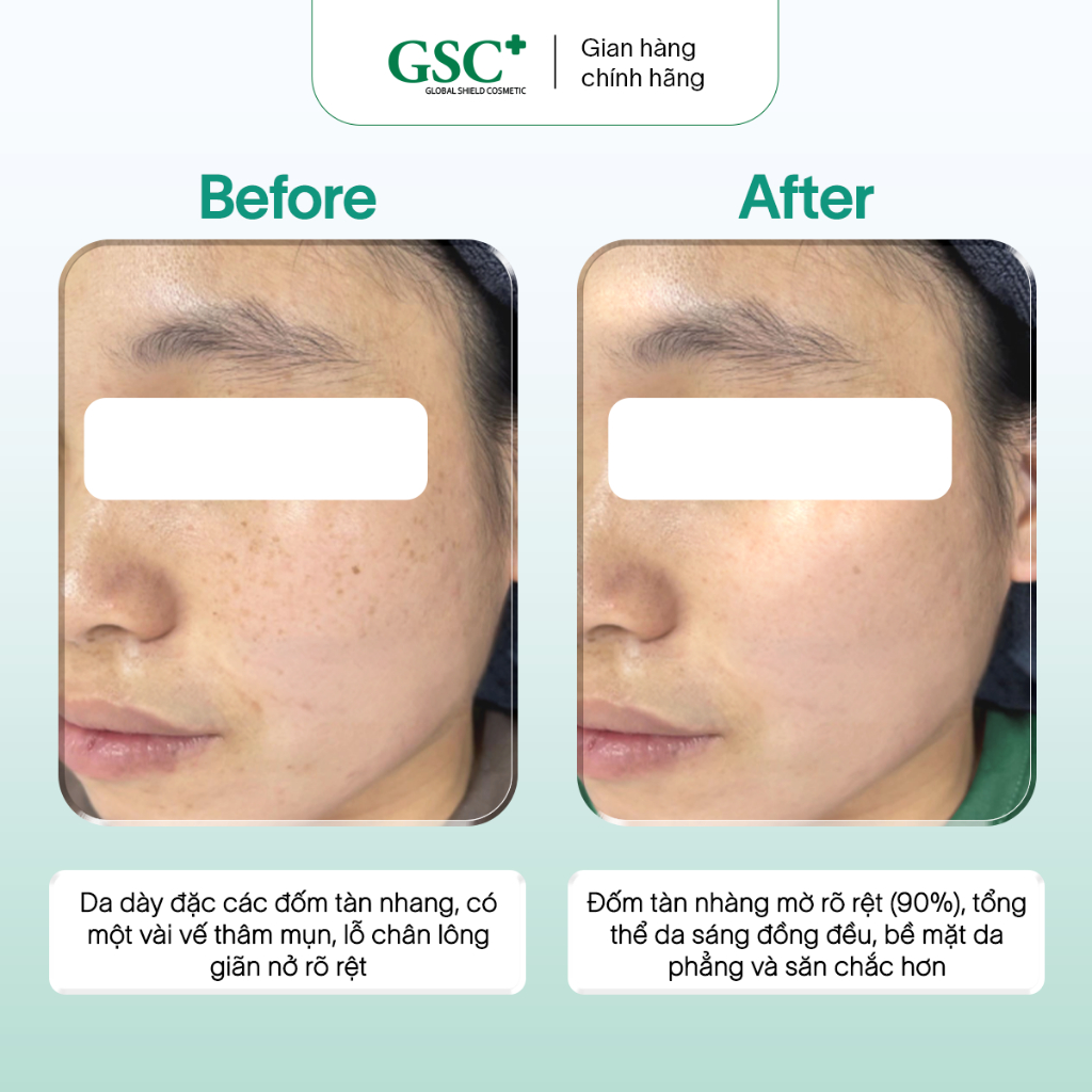 Kem Nám Tàn Nhang Hàn Quốc GSC Alpha Arbutin Ultra Cream 15g – Kem Hỗ Trợ Làm Mờ Và Ngăn Ngừa Thâm Nám - GC090A