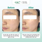 Kem Nám Tàn Nhang Hàn Quốc GSC Alpha Arbutin Ultra Cream 15g – Kem Hỗ Trợ Làm Mờ Và Ngăn Ngừa Thâm Nám - GC090A — ảnh 6